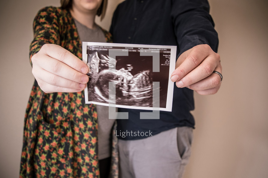 mother and father holding an ultrasound picture 
