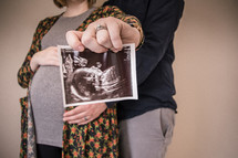 mother and father holding an ultrasound picture 