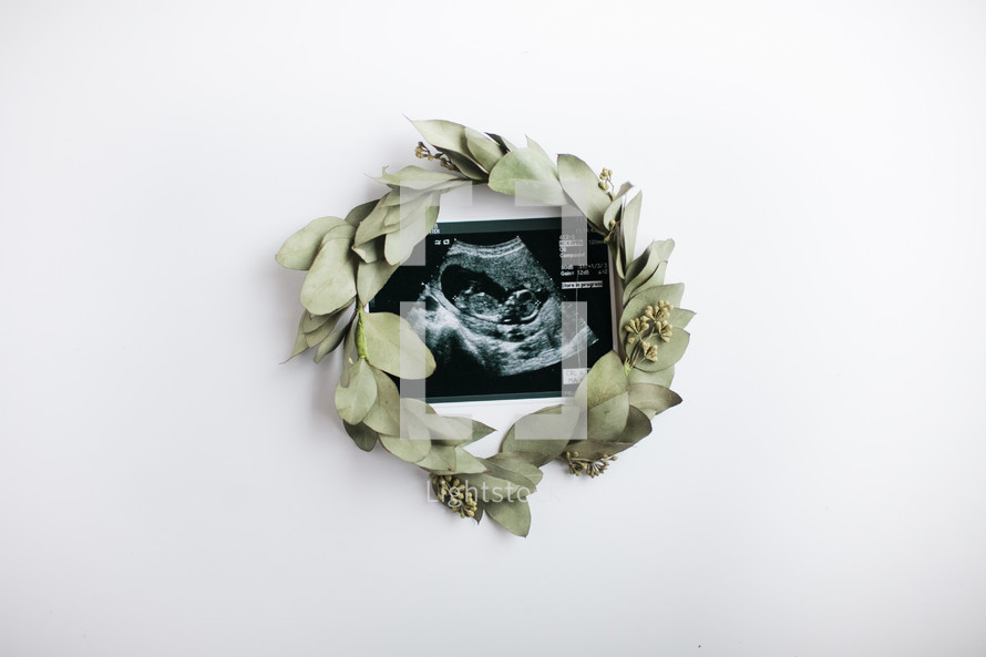 wreath around an ultrasound photograph 