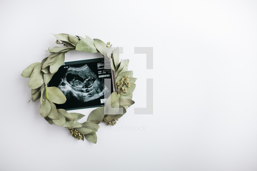 ultrasound photo and wreath 