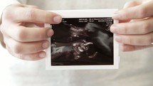 mother holding an ultrasound 